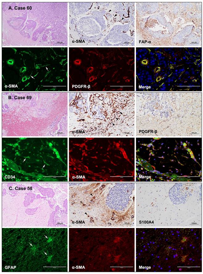 J Cancer Image