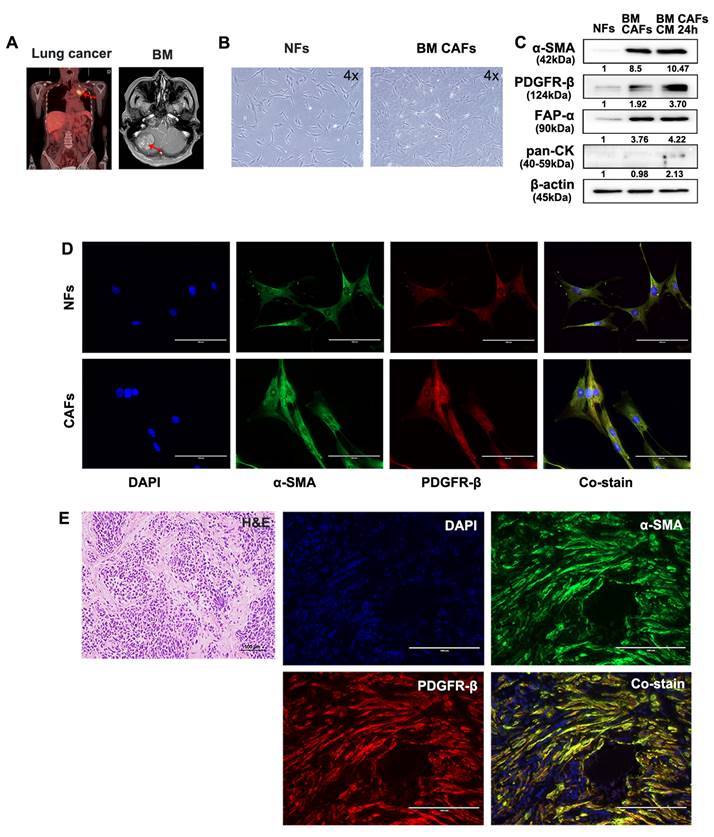 J Cancer Image