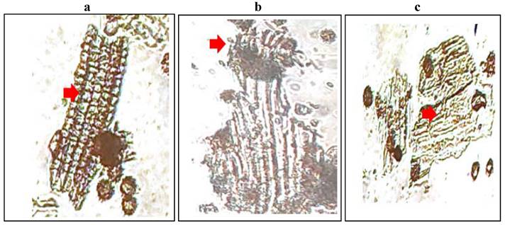 J Cancer Image