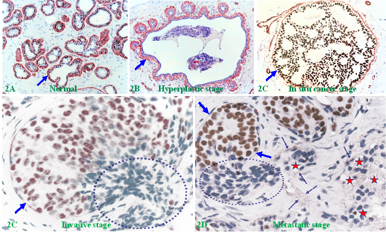 J Cancer Image