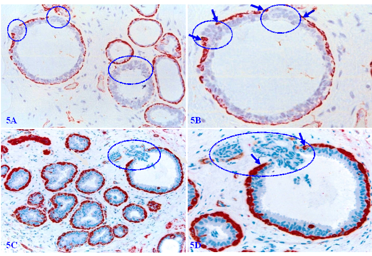 J Cancer Image