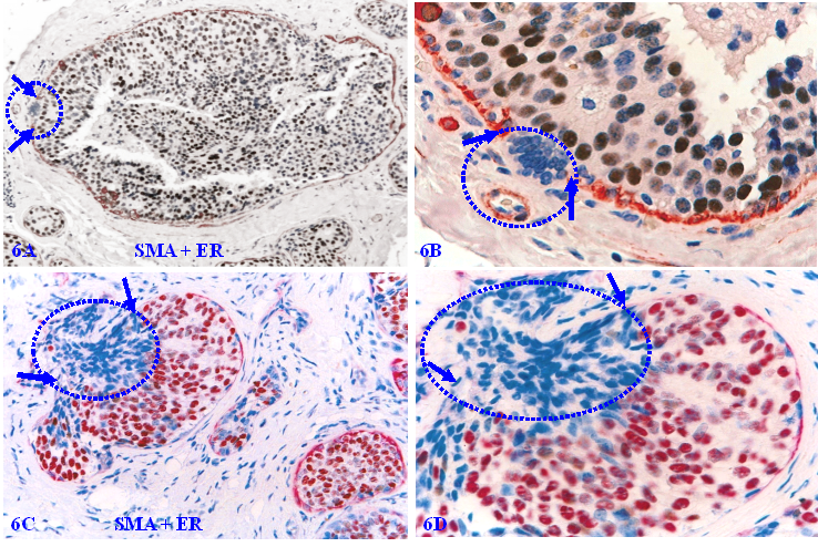 J Cancer Image