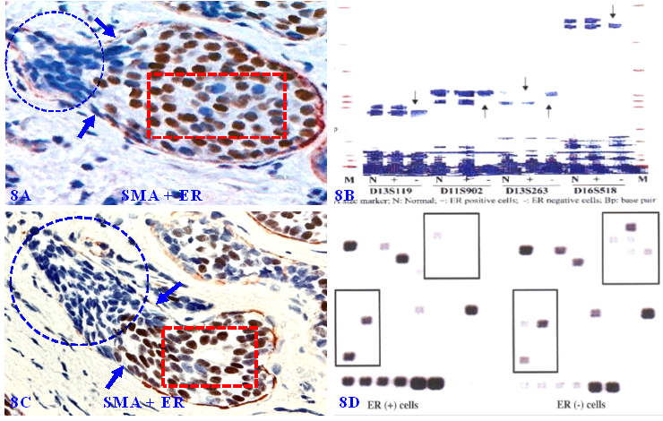 J Cancer Image