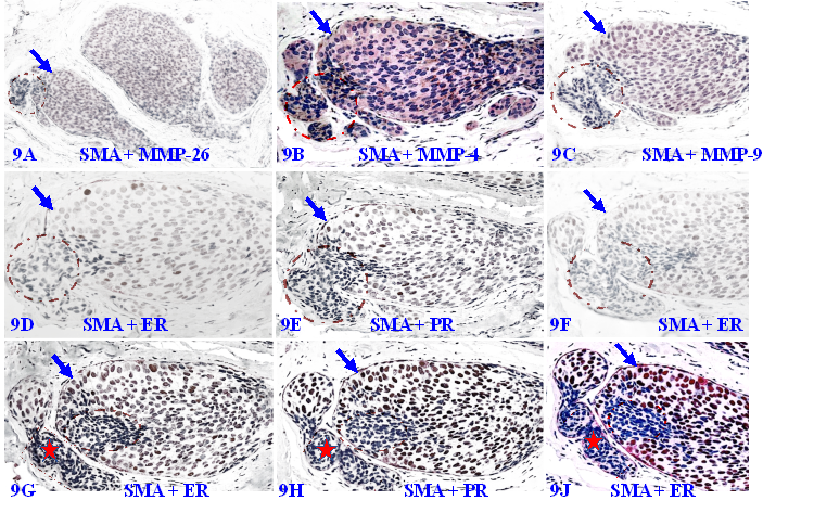 J Cancer Image