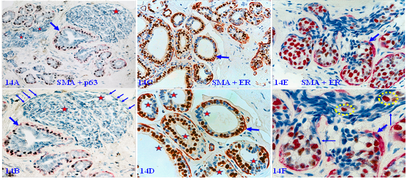 J Cancer Image