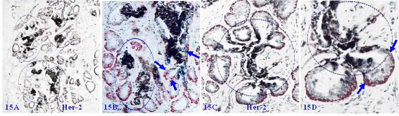 J Cancer Image