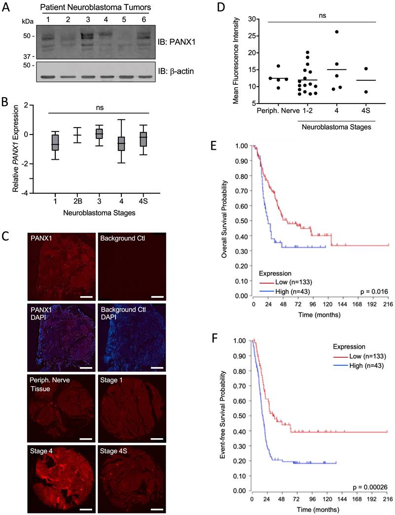 J Cancer Image