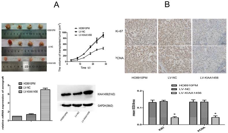 J Cancer Image