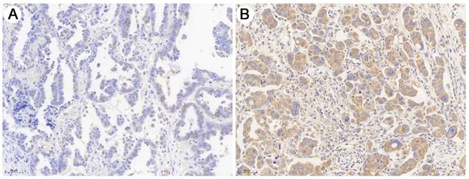 J Cancer Image