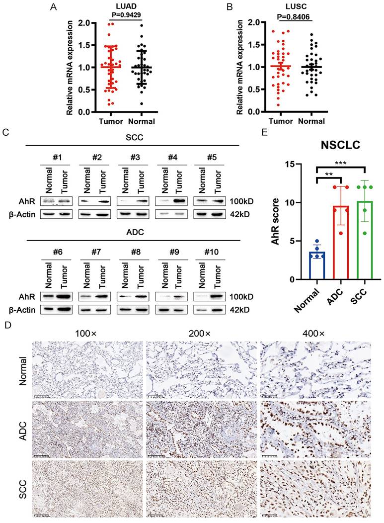 J Cancer Image