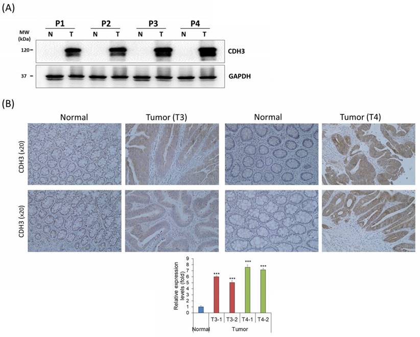 J Cancer Image