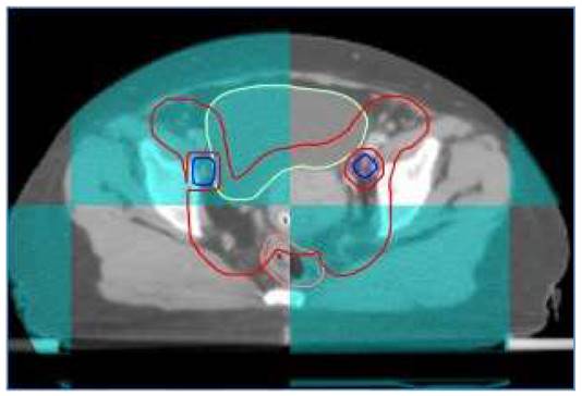 J Cancer Image