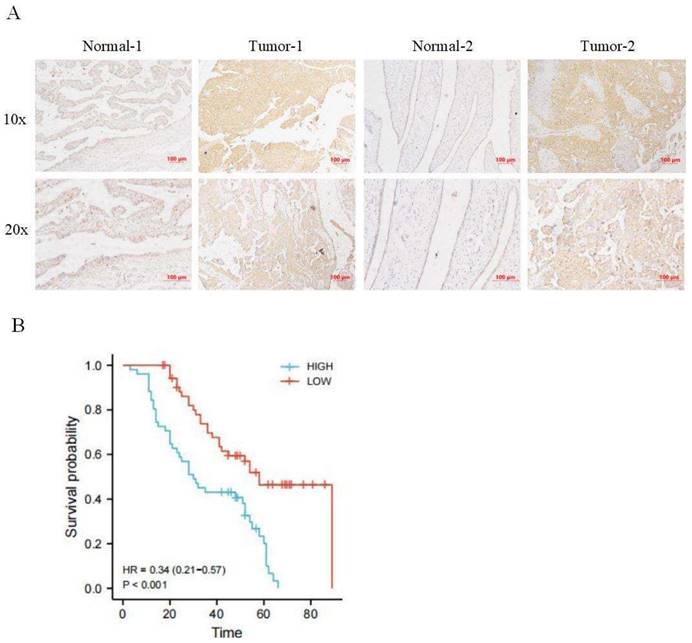 J Cancer Image