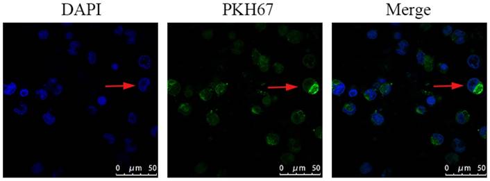 J Cancer Image