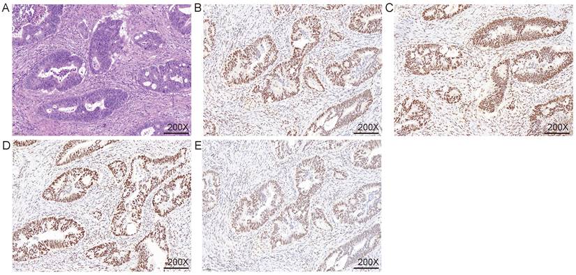 J Cancer Image