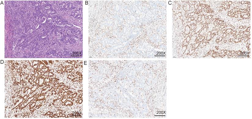 J Cancer Image