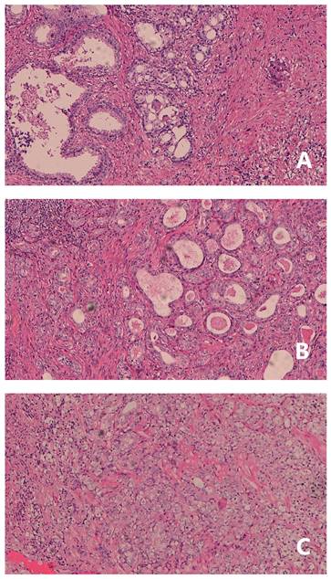 J Cancer Image