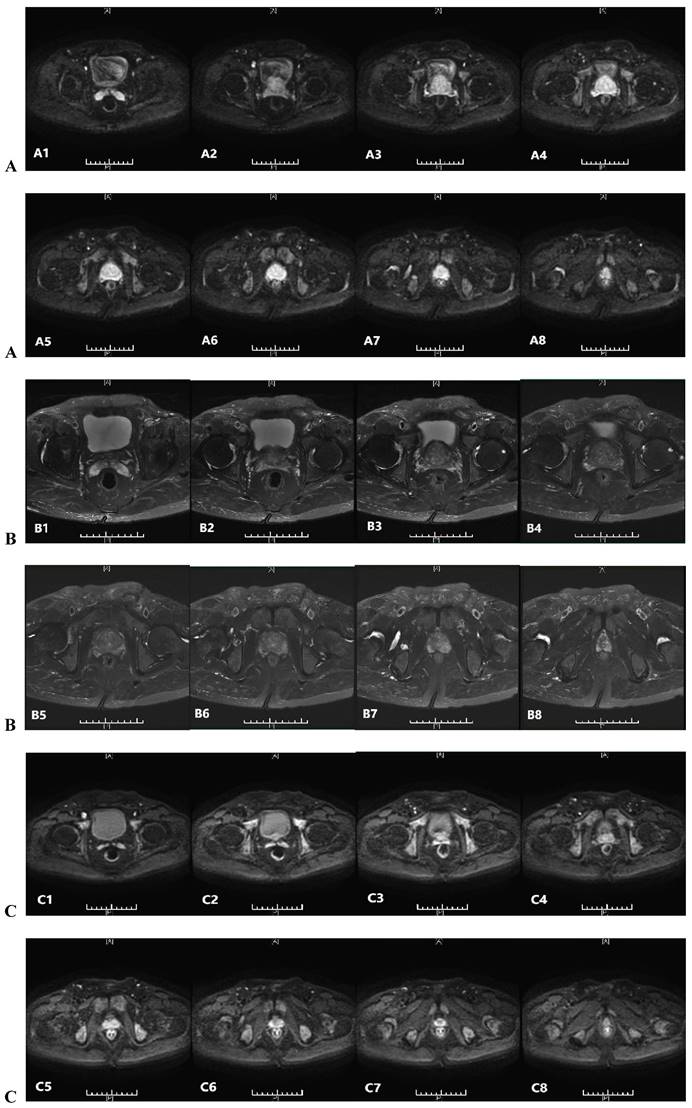 J Cancer Image