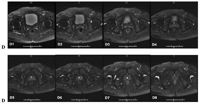 J Cancer Image