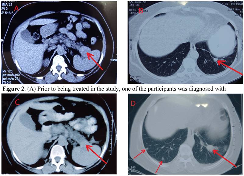 J Cancer Image