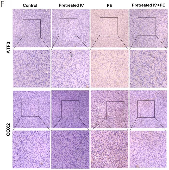 J Cancer Image