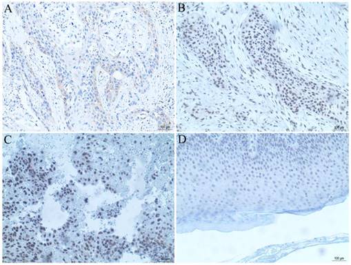 J Cancer Image