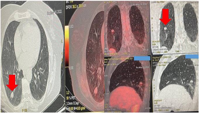 J Cancer Image