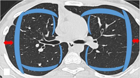 J Cancer Image