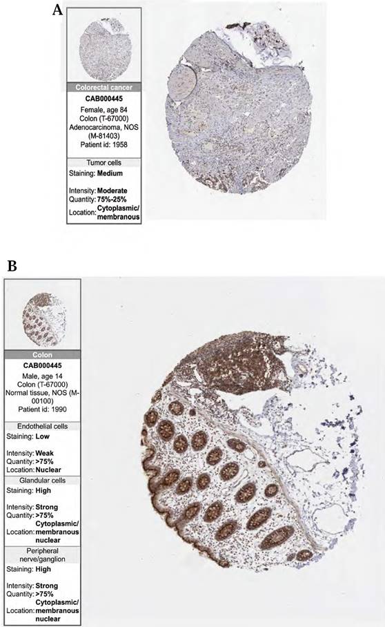 J Cancer Image