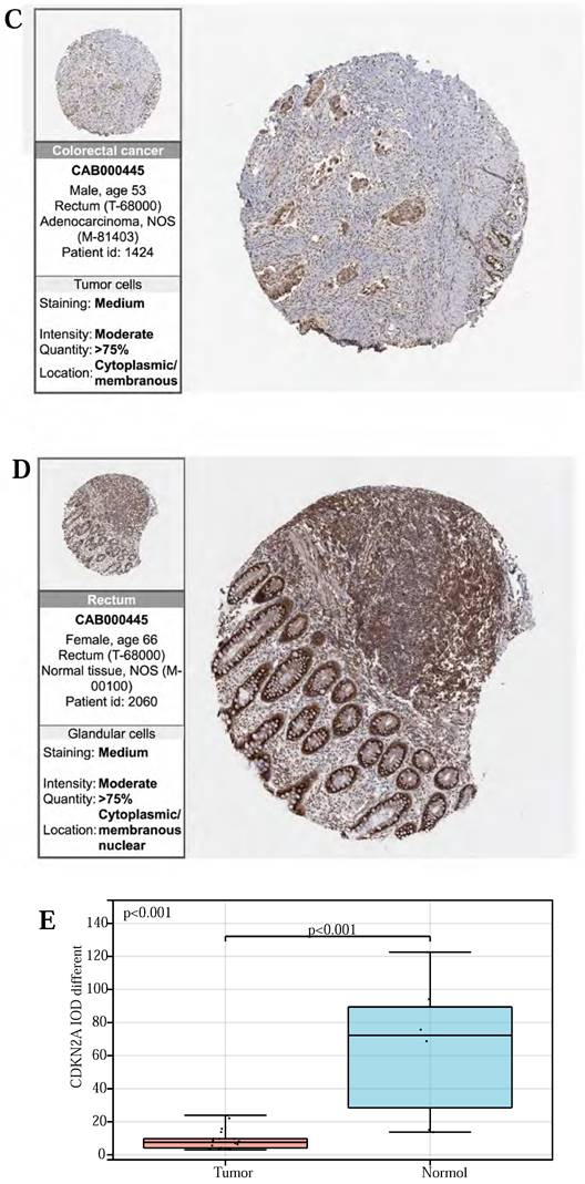 J Cancer Image