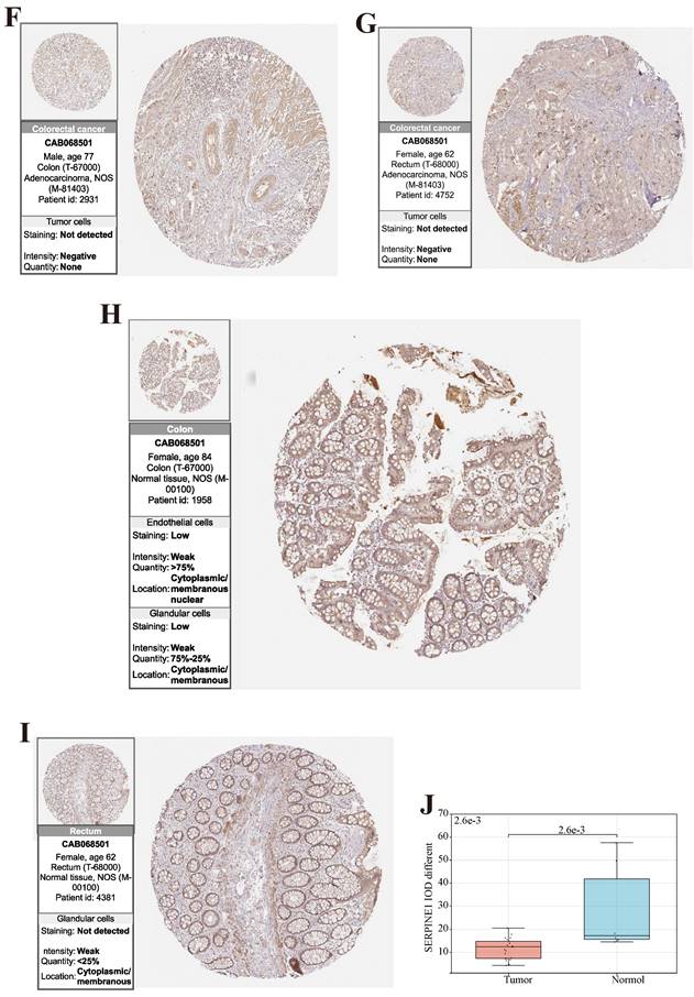 J Cancer Image