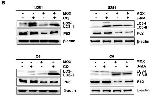 J Cancer Image