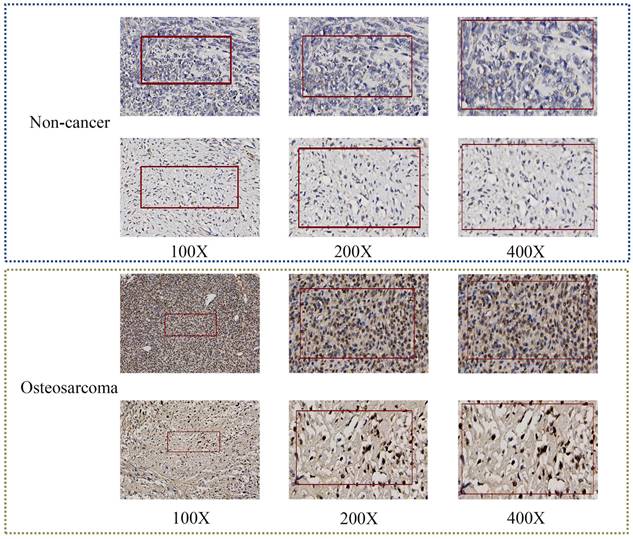 J Cancer Image