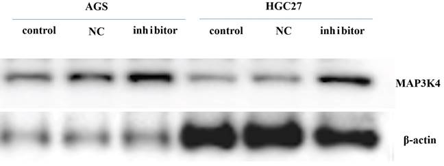 J Cancer Image