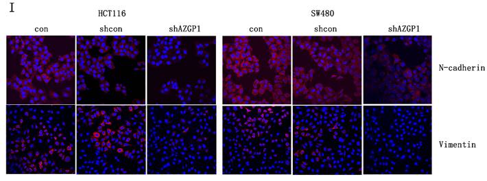 J Cancer Image