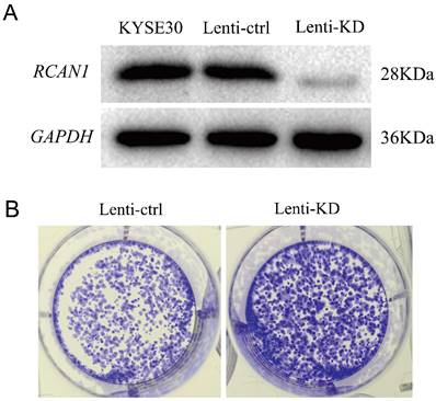 J Cancer Image