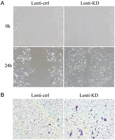 J Cancer Image