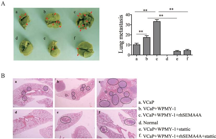 J Cancer Image