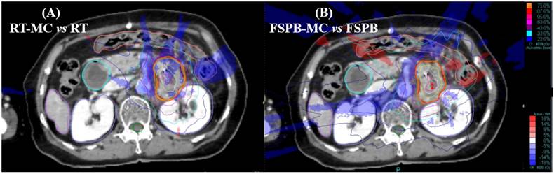 J Cancer Image