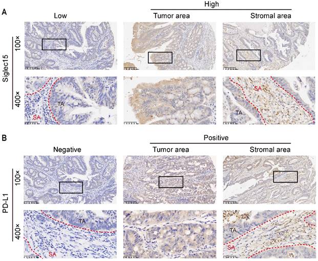 J Cancer Image