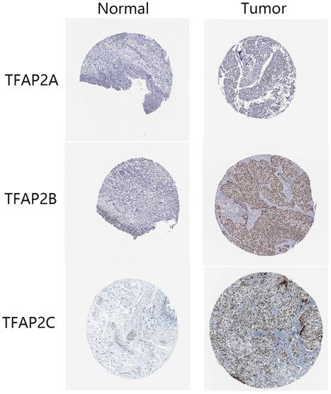 J Cancer Image