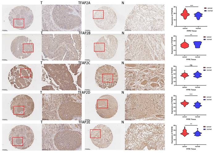 J Cancer Image