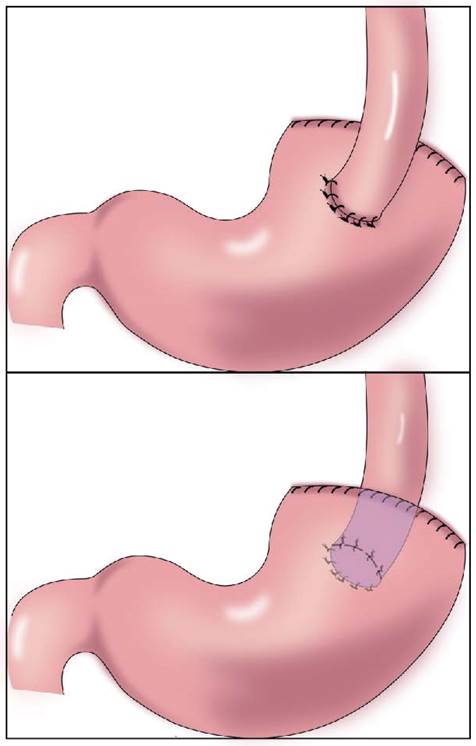 J Cancer Image