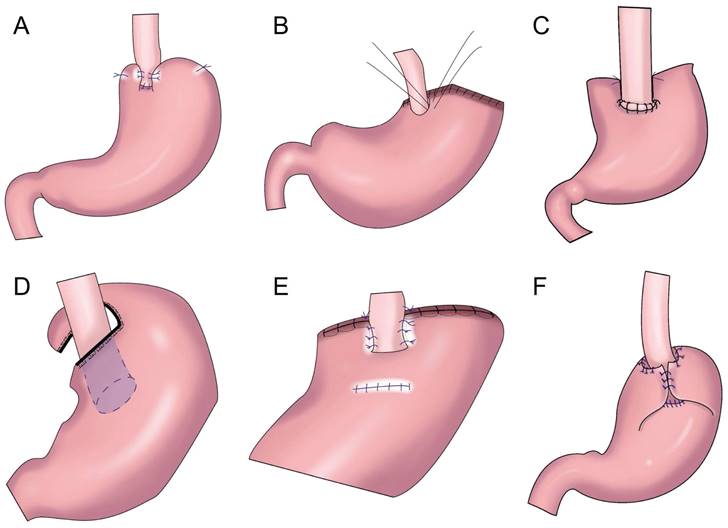 J Cancer Image