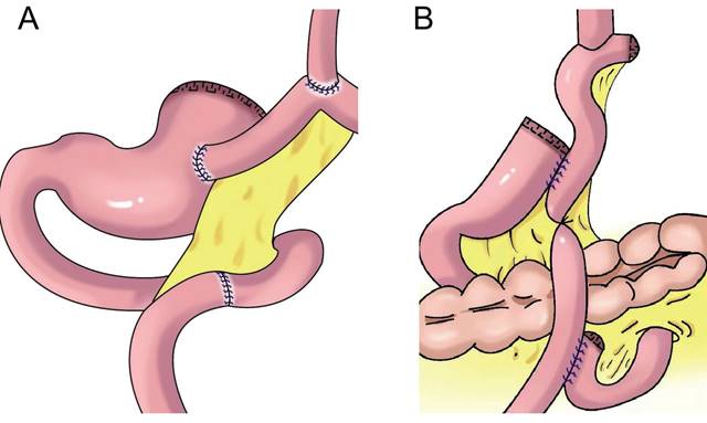 J Cancer Image