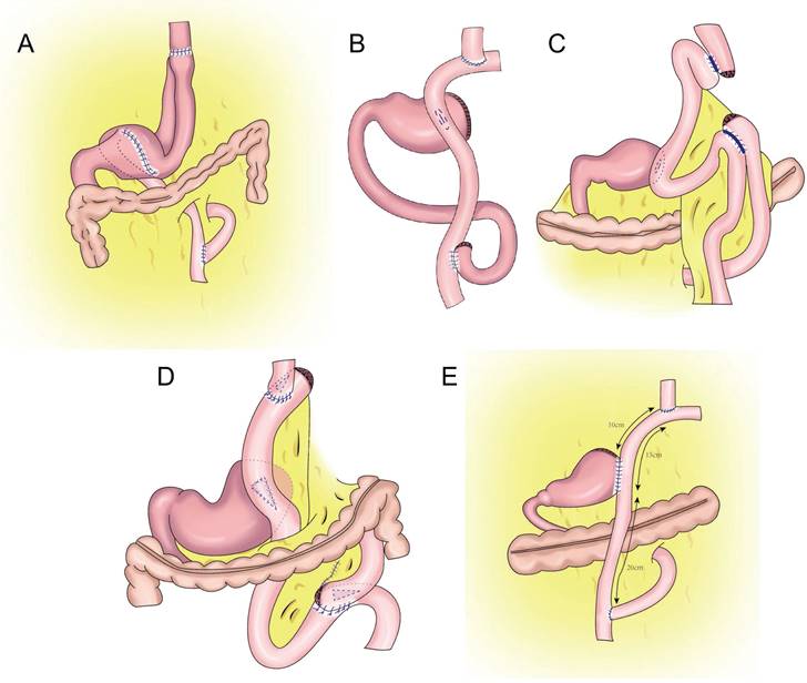 J Cancer Image