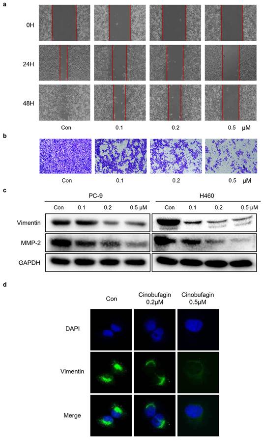 J Cancer Image