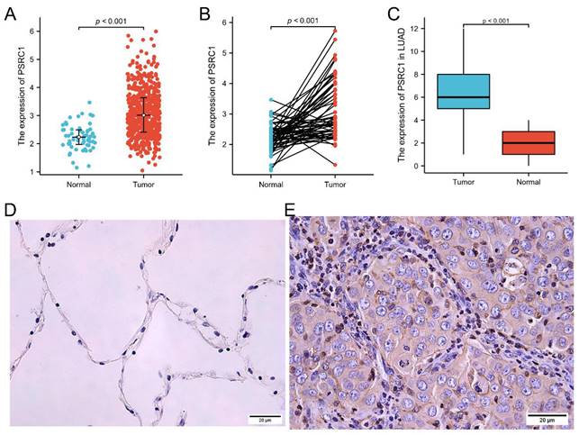 J Cancer Image