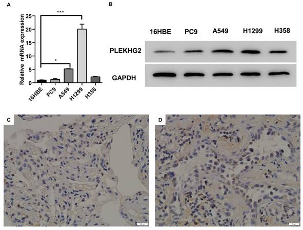 J Cancer Image