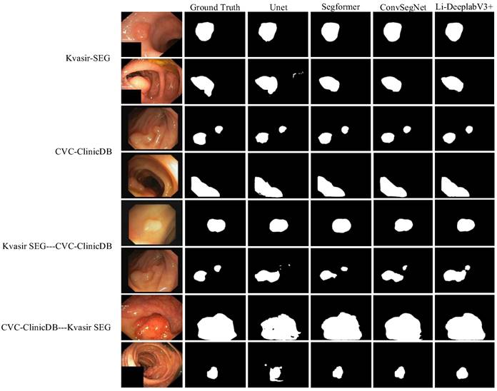 J Cancer Image